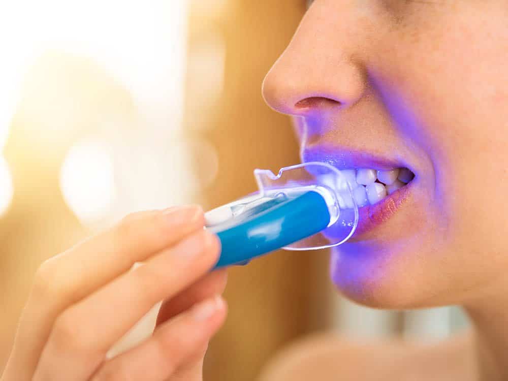 Meilleur Kit De Blanchiment Dentaire Test, Avis, Comparatif Mai 2026 ⇒ — free download
